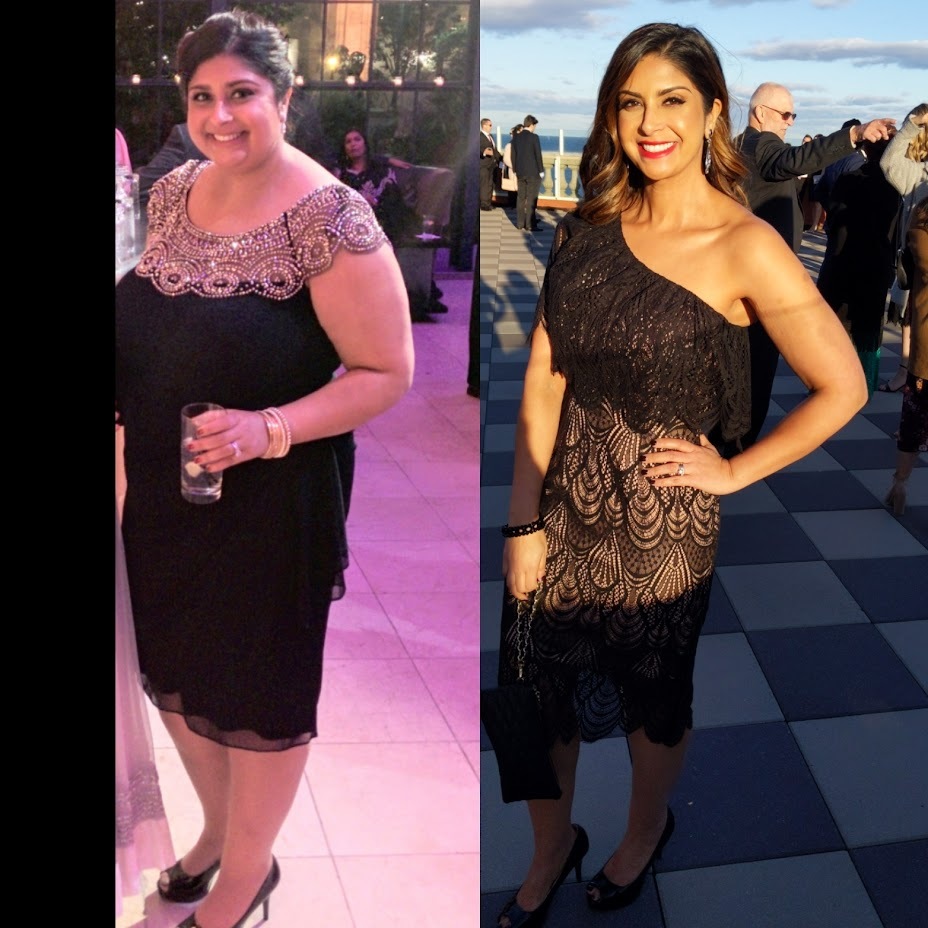 jersey-med-before-after